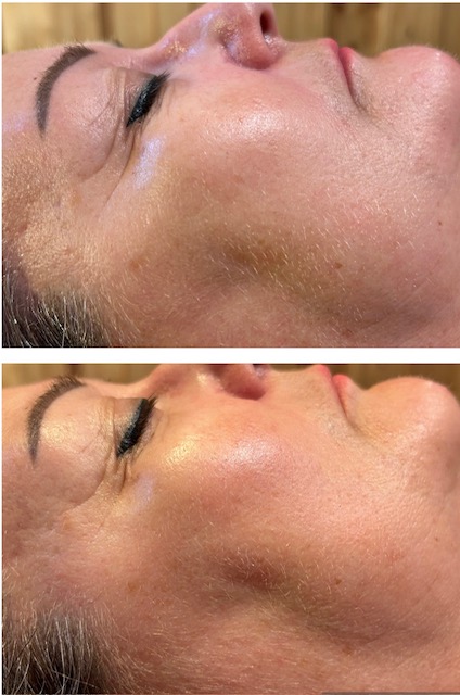 Résultats en une séance